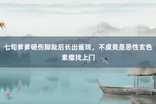 七旬爹爹砸伤脚趾后长出雀斑，不虞竟是恶性玄色素瘤找上门